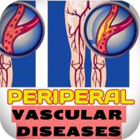 Peripheral Vascular Diseases (PVD) and Management on 9Apps