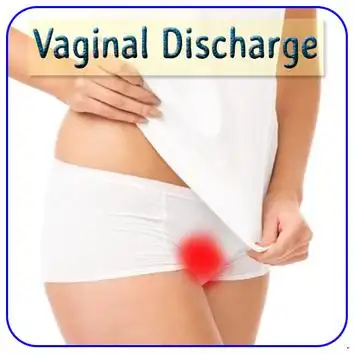 Téléchargement de l'application Vaginal Discharge 2024 - Gratuit