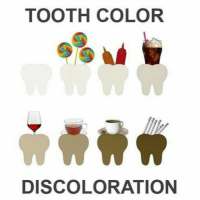 Tooth Discoloration (Stain) on 9Apps