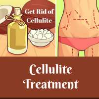 Cellulite Treatment on 9Apps