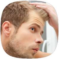 How to Stop Baldness Thinning Hair (Guide)