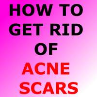 HOW TO GET RID OF ACNE SCARS