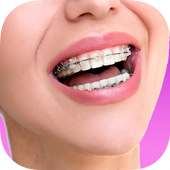 Top Design Braces teeth on 9Apps