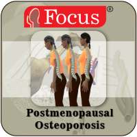 Postmenopausal Osteoporosis on 9Apps