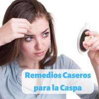 Remedios Caseros para la Caspa del Cabello Graso