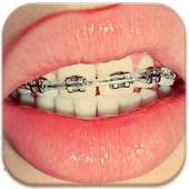 Braces Teeth Booth Pro