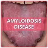 Amyloidosis Disease on 9Apps