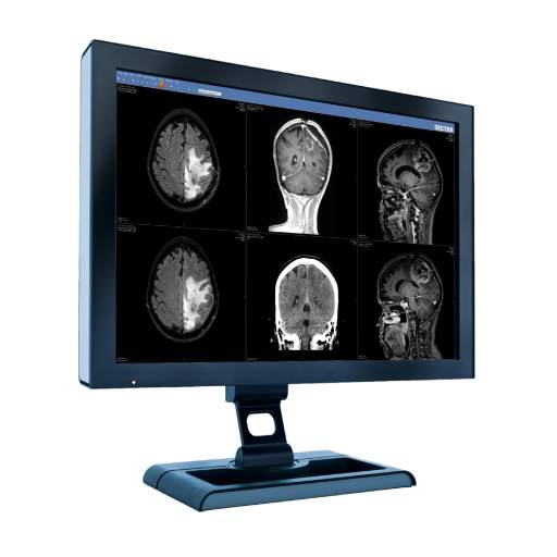 CT Brain Imaging Variations -A Comprehensive Atlas