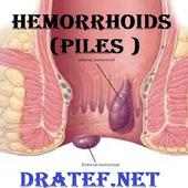 Hemorrhoids  (Piles) on 9Apps