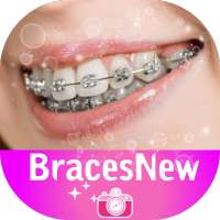 BracesNew on 9Apps