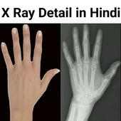 X Ray Details - एक्स रे जानकारी