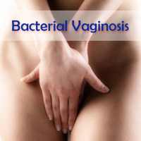 Bacterial Vaginosis - Sexual Diagnosis & Treatment on 9Apps