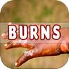 Burns: Causes, Diagnosis, and Management
