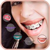 Braces Photo Editor on 9Apps