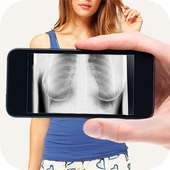 X-Ray Body Scanner Free
