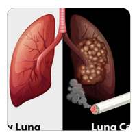 Lung cancer guide on 9Apps