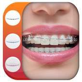 Real Braces teeth Photo Editor on 9Apps