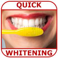 How to Whiten Teeth Instantly
