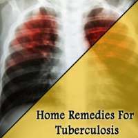 Home Remedies For Tuberculosis (TB)