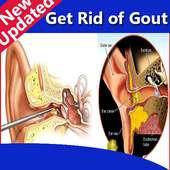 Get Rid of Gout on 9Apps
