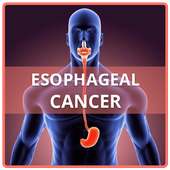 Esophageal Cancer on 9Apps