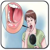 Treat Canker Sores