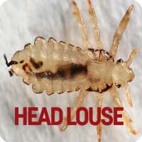 Head Louse