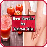 Home Remedies for Varicose Veins on 9Apps