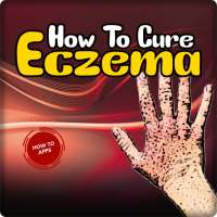 How To Cure Eczema on 9Apps