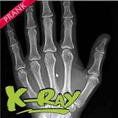 X-Ray Scanner Fun