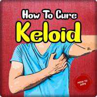 How To Cure Keloid on 9Apps