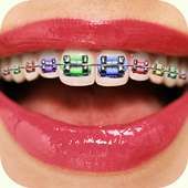 Braces Teeth Editor 2018 on 9Apps