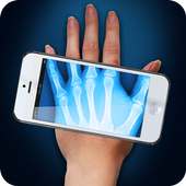 X-Ray Camera Fingers