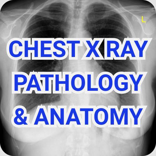 Chest X Ray Pathology And Anatomy