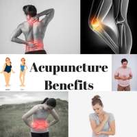 ACUPUNCTURE BENEFITS - ACHIEVING BETTER HEALTH