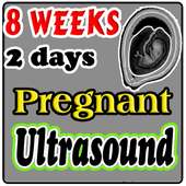 8 Weeks 2 Days Pregnant Ultrasound Guide