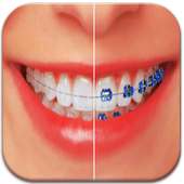 Braces Teeth Booth Maker Pro on 9Apps