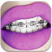 Braces- HD Camera Braces Booth on 9Apps