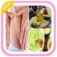 home remedies for stretch marks on 9Apps