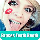 Braces Booth on 9Apps