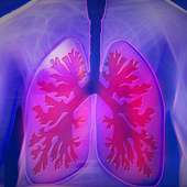 Essential Facts About Lung Cancer