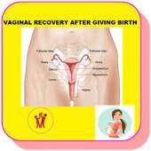 How to Recover your Vaginal size after Birth on 9Apps