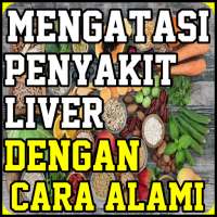 Mengatasi Penyakit Liver Dengan Cara Alami