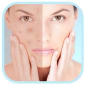 Face Blemishes Removal on 9Apps