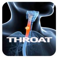 Throat Cancer