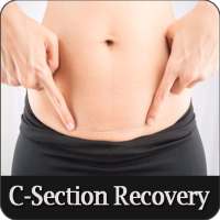 C-Section Recovery on 9Apps