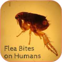 Signs of Flea Bites. on 9Apps