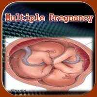 Multiple Pregnancy on 9Apps