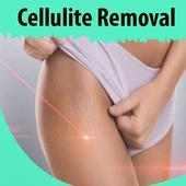 Cellulite Removal on 9Apps