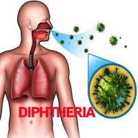 Diphtheria Disease on 9Apps